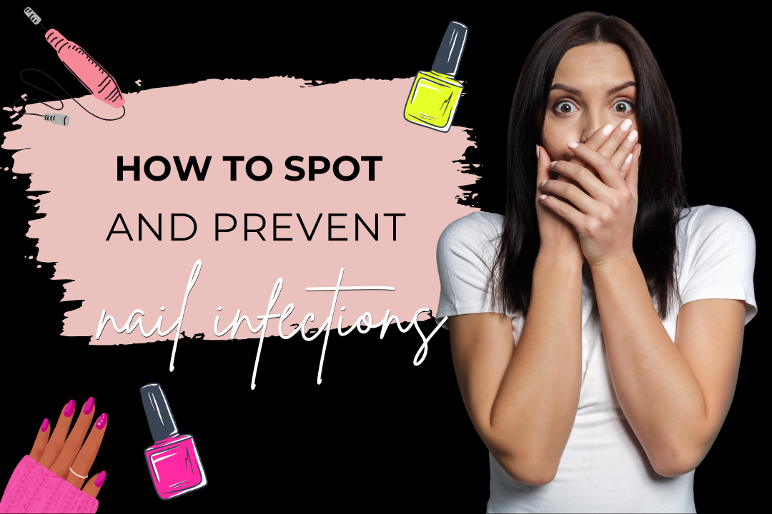 How to Spot and Prevent Nail Infections